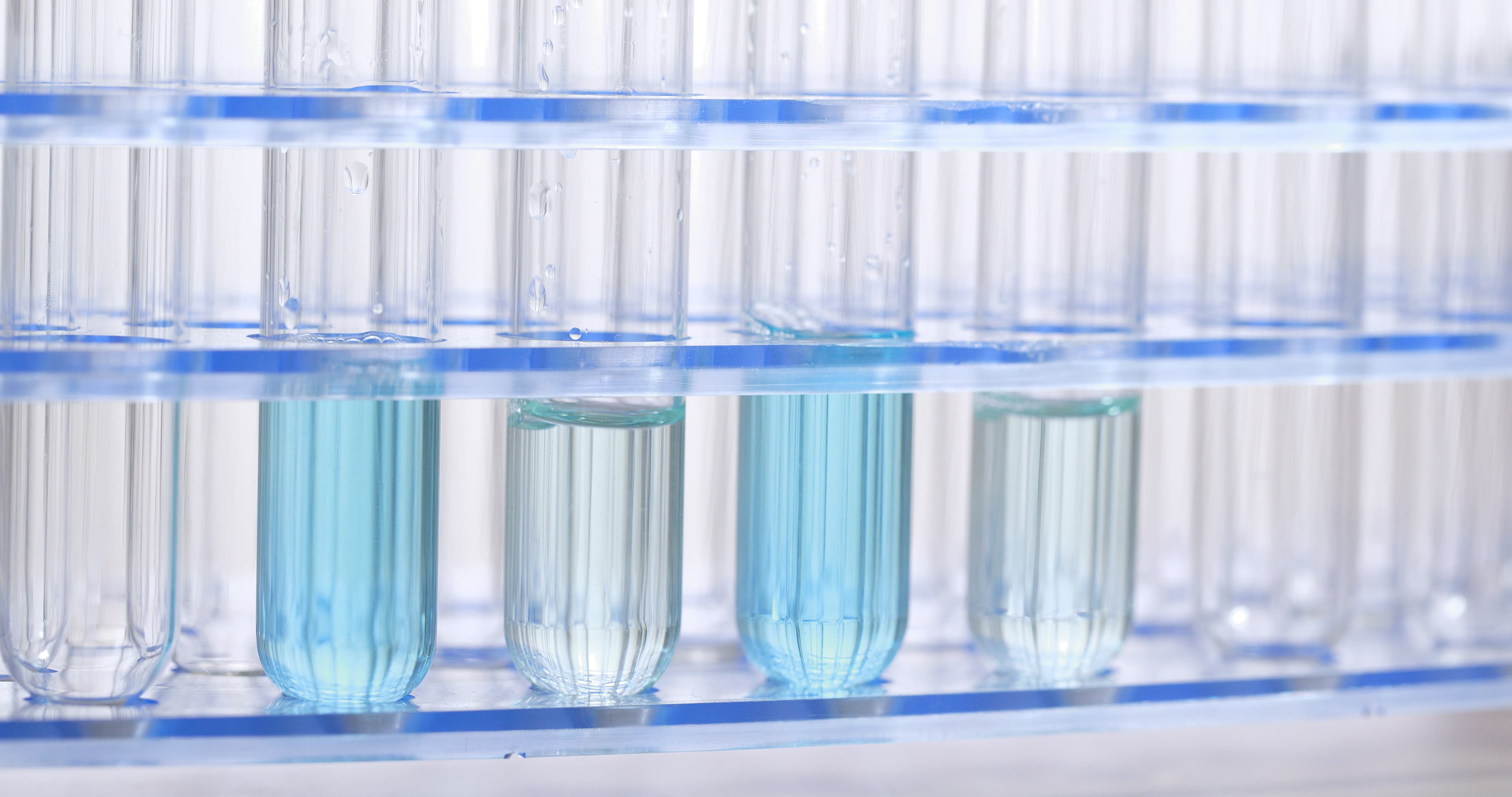 Laboratory tests at your place